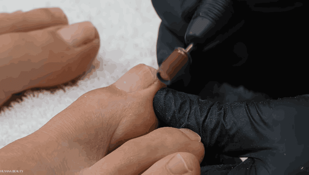 Nails adjustment